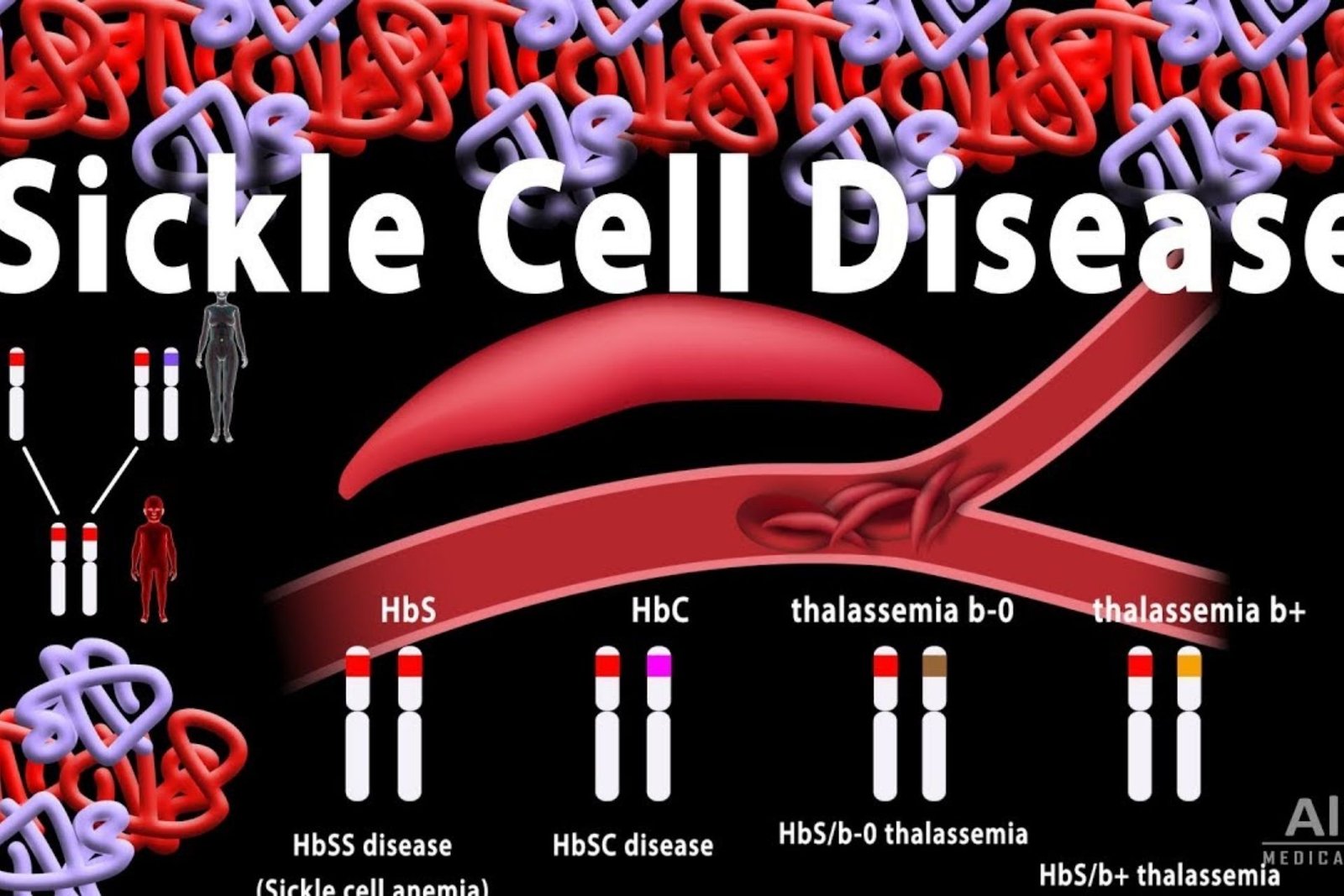 SICKLE CELL
